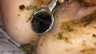 Asian amateur scat couple - video 5, ScatKings.com Scat Porn 12 ScatKings.com Scat Porn