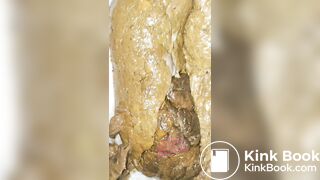 Chinese woman naked poop, ScatKings.com Scat Porn 2 ScatKings.com Scat Porn
