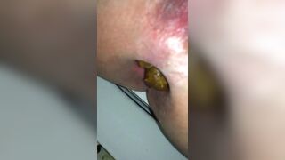 Close up - video 6, ScatKings.com Scat Porn 13 ScatKings.com Scat Porn