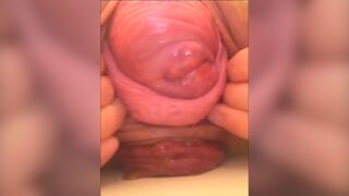 Scat by Prolapsing, ScatKings.com Scat Porn 7 ScatKings.com Scat Porn