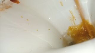 Trip number 5 :-D, ScatKings.com Scat Porn 16 ScatKings.com Scat Porn